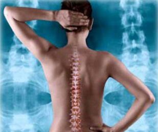 zadní páteř ilustrace