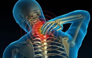 proč dochází k cervikální osteochondróze