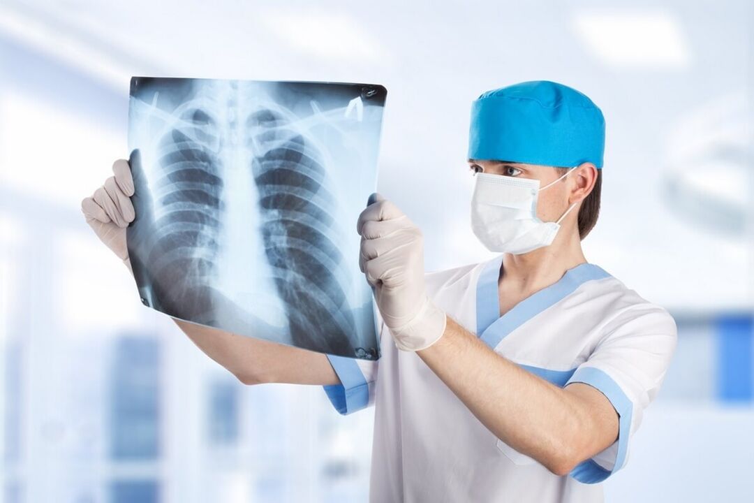 Rentgenový snímek hrudníku s osteochondrózou