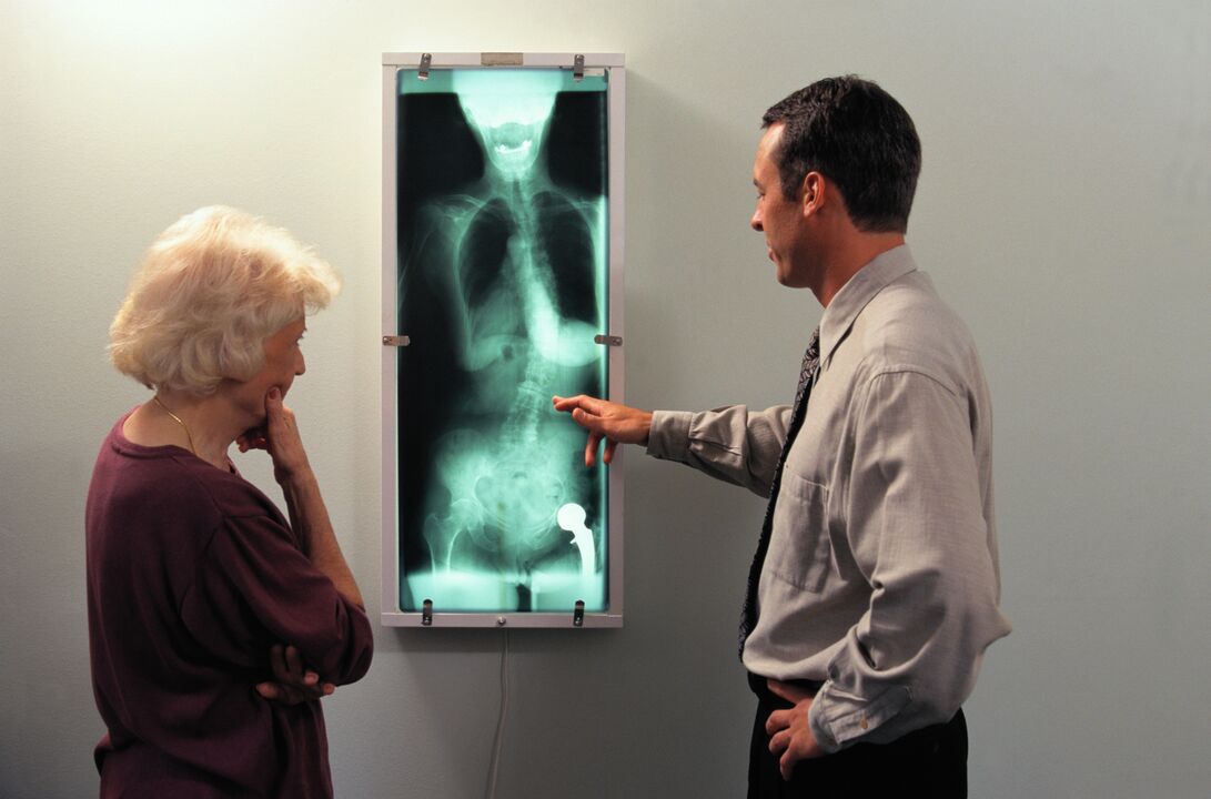 rentgenová diagnostika bolesti v kyčelním kloubu